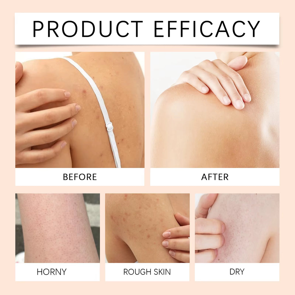 Papaya Whitening Shower Gel Exfoliating Fade Pigmentation Lasting Aroma Refreshing Control Oil Hydrating Rich Foam Body Wash